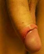 Photos de la bite de Groszisi, Gland