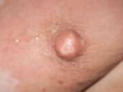 Photos des seins de Blob68, gros plan